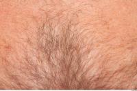 human skin hairy 0003